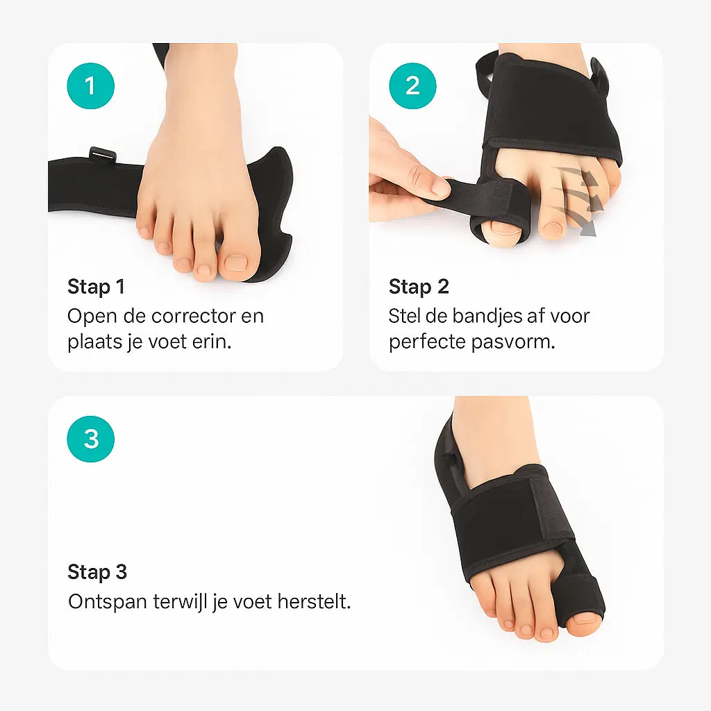 Esavie Hallux Valgus Corrector